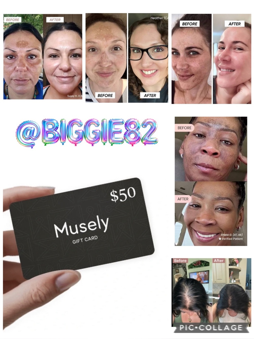 ❤️FREE! Musely $50 Gift Card The Spot Cream Anti-Aging KP Body Cream Dark Spot